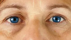 O erro mais comum nos cuidados - as rugas à volta dos olhos só vão piorar
