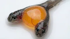 Duas cabeças e um corpo: cientistas encontram acidentalmente gêmeos siameses raros